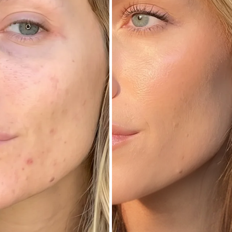 The Glow Duo